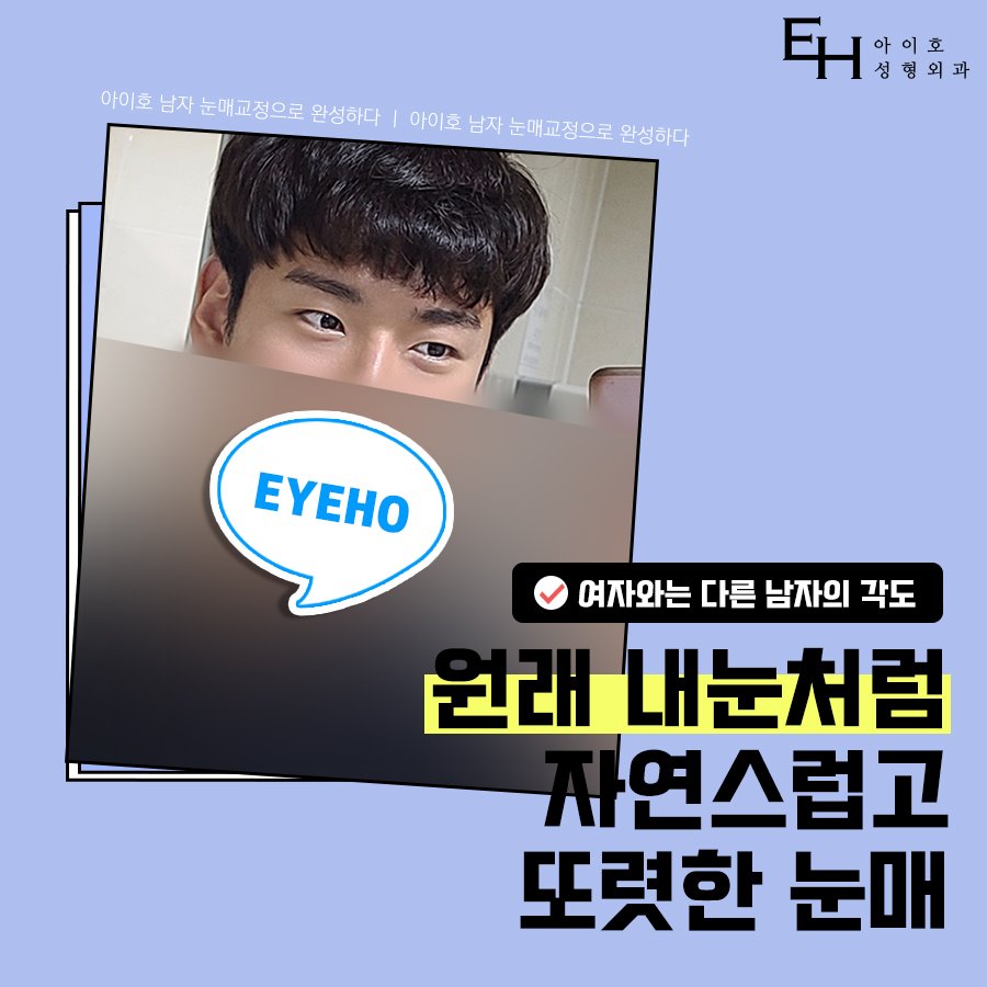 남자눈성형가격 현혹되지 말고 남자눈성형잘하는곳 찾아야 관련 이미지 1