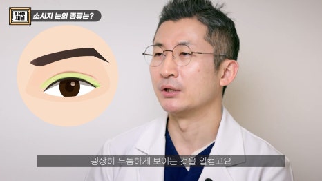 소세지눈 다 같은 게 아니다!? 유형별 재수술 방법에 대해 알려드리겠습니다. 관련 이미지 3