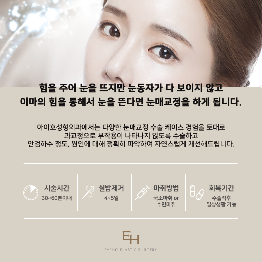 눈매교정가격 알아보고 있다면 관련 이미지 3