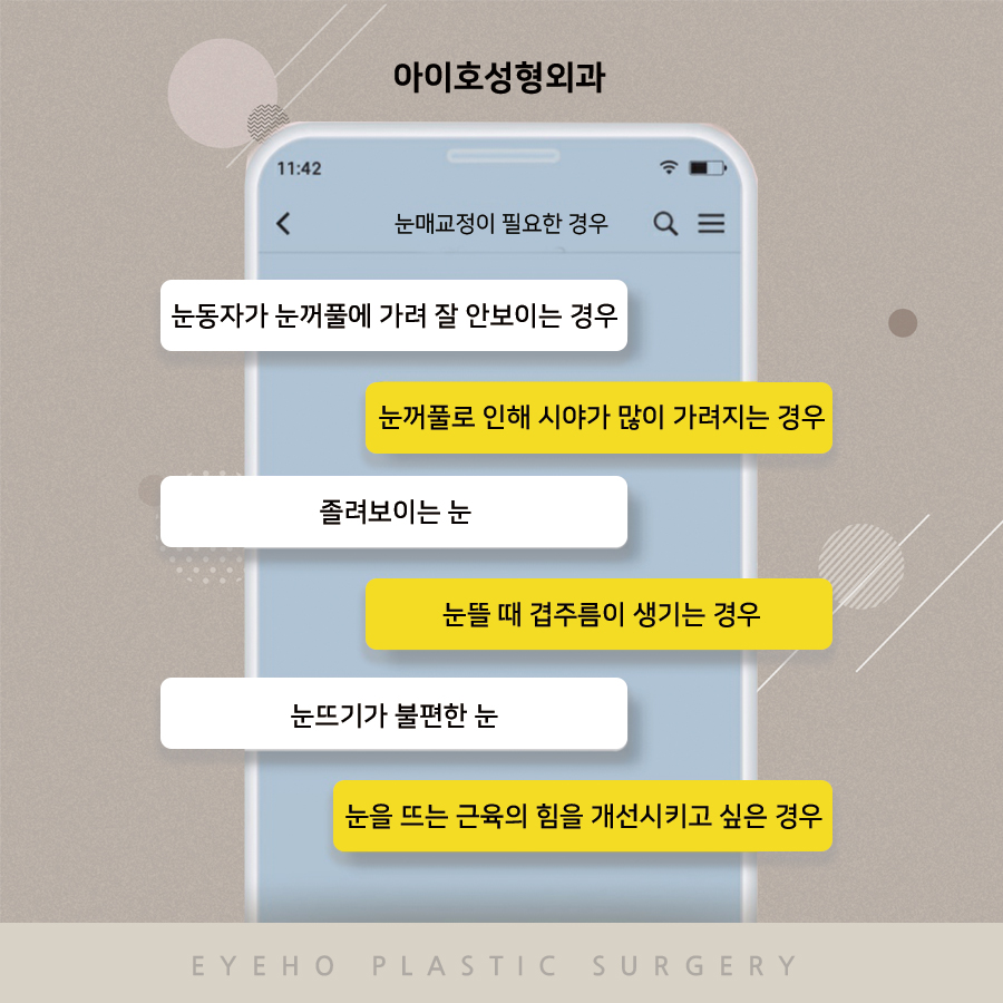 눈매교정가격 알아보고 있다면 관련 이미지 5