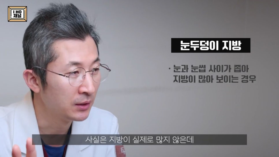 Upper Eyelid Fat Removal: Solving the Problem of Puffy-Looking Eyes!! image 7