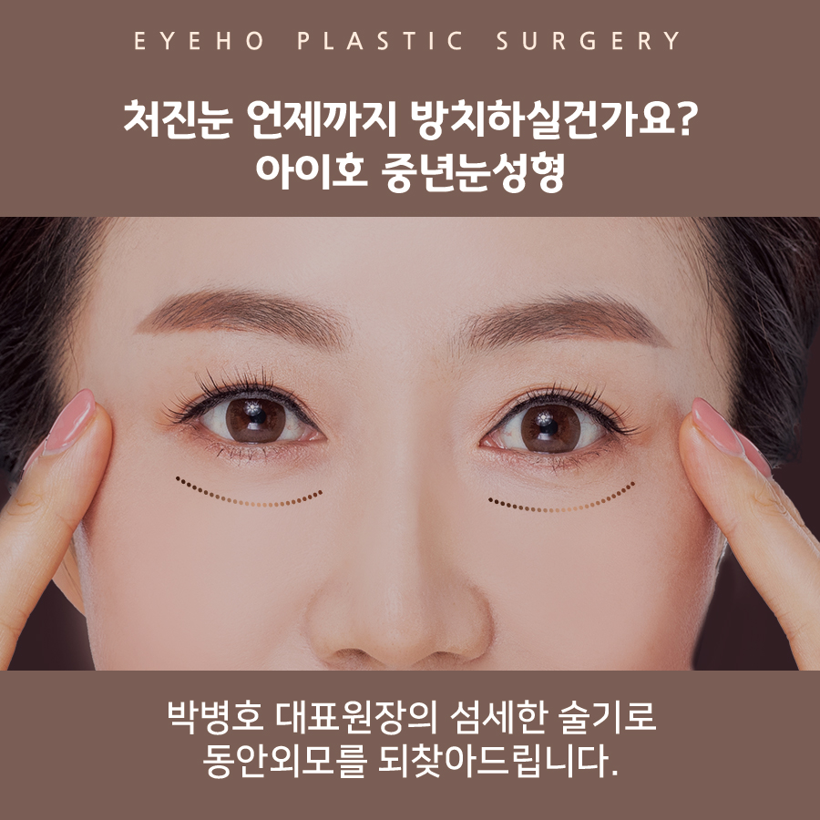 하안검 수술 후기 : 눈 밑 하안검 흉터 & 통증 / 잘하는곳 비교 분석 관련 이미지 6