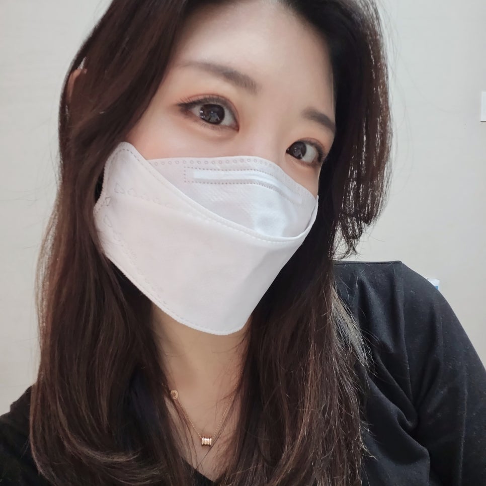 Double Eyelid Revision Surgery Review: You Must Be Careful with Extremely Difficult Eyes image 16
