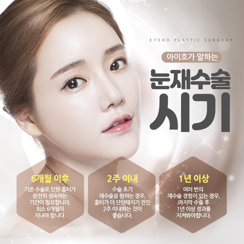Double Eyelid Revision Surgery Cost: Check Everything Carefully, Including the Results image 4
