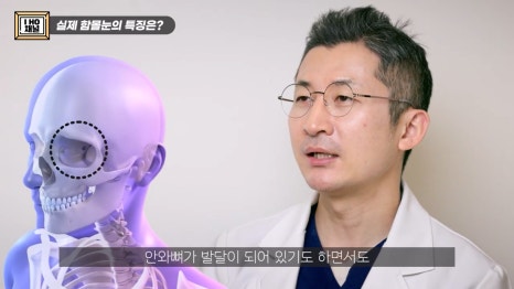 함몰눈 드라마틱한 결과를 얻는 방법은 따로 있다. 관련 이미지 1