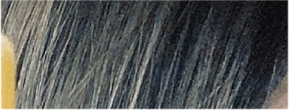 눈재수술비용 원인 파악을 우선으로 관련 이미지 20