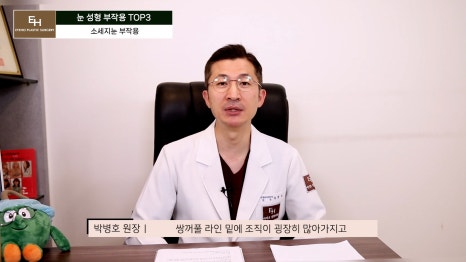 눈재수술 고민이신 분들 주목!! 관련 이미지 20