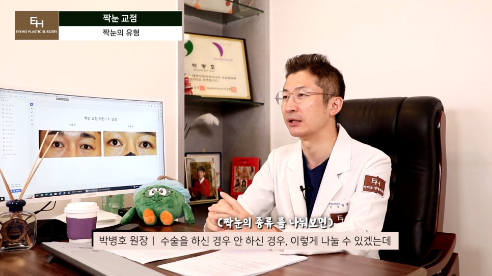 짝눈이 고민인데 양쪽 눈 수술하기 싫어요!! 한쪽 눈만 수술 가능!? 관련 이미지 8