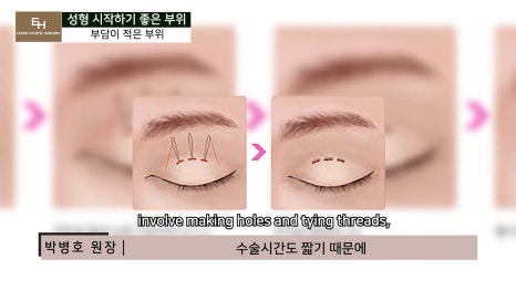 Good Things to Remember When Deciding on Your First Cosmetic Surgery image 19