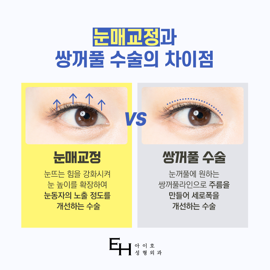 남자눈매교정비용 알아보고 계신다면 관련 이미지 2