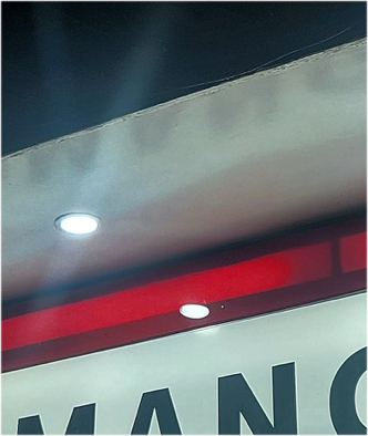 눈매교정 안검하수수술 비용 그리고 무쌍눈매교정후기 N일차 관련 이미지 21