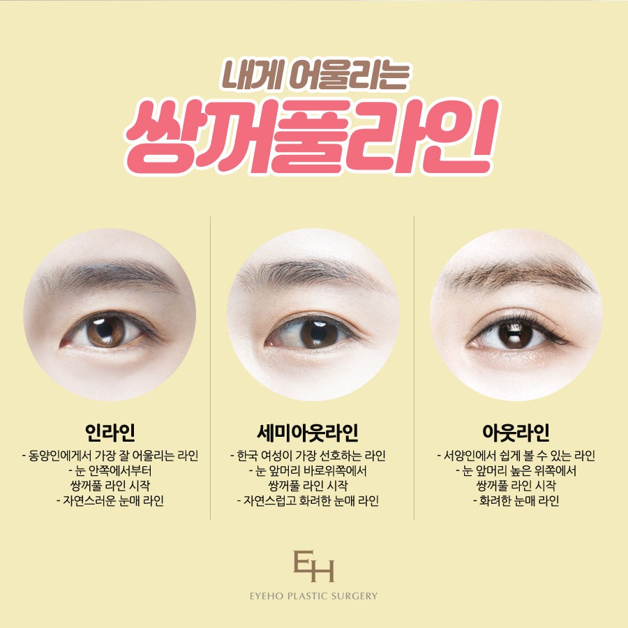 눈성형잘하는곳 아이호성형외과 관련 이미지 5