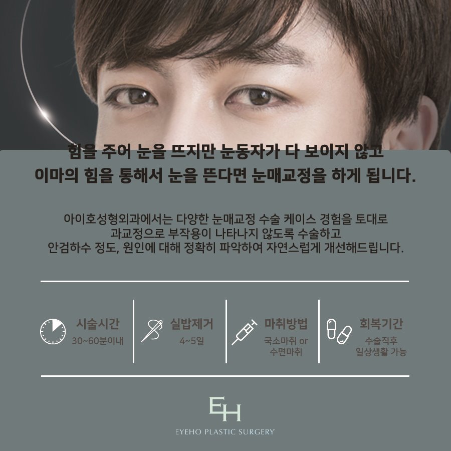 남자눈매교정전후 세세하게 파악해보면서 관련 이미지 2