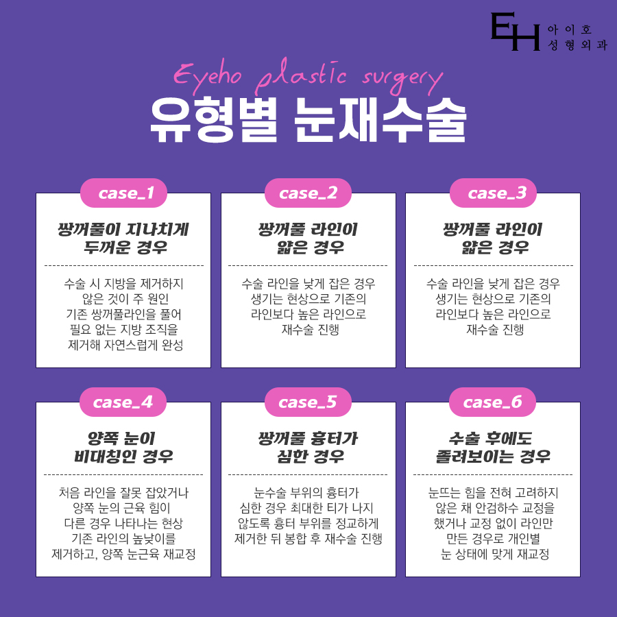 쌍꺼풀재수술비용 꼼꼼하게 살펴야 관련 이미지 6