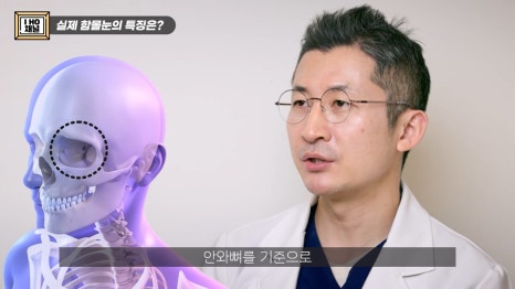 함몰눈 드라마틱한 결과를 얻는 방법은 따로 있다. 관련 이미지 2