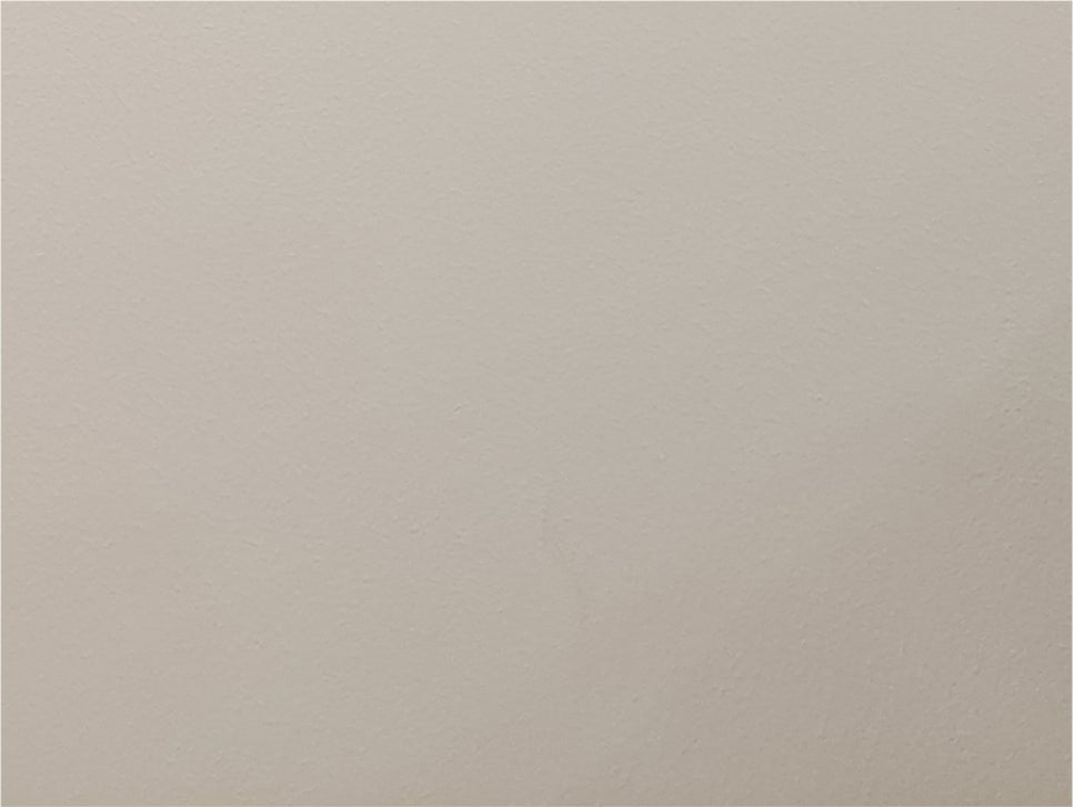 남자눈성형가격 현혹되지 말고 남자눈성형잘하는곳 찾아야 관련 이미지 25