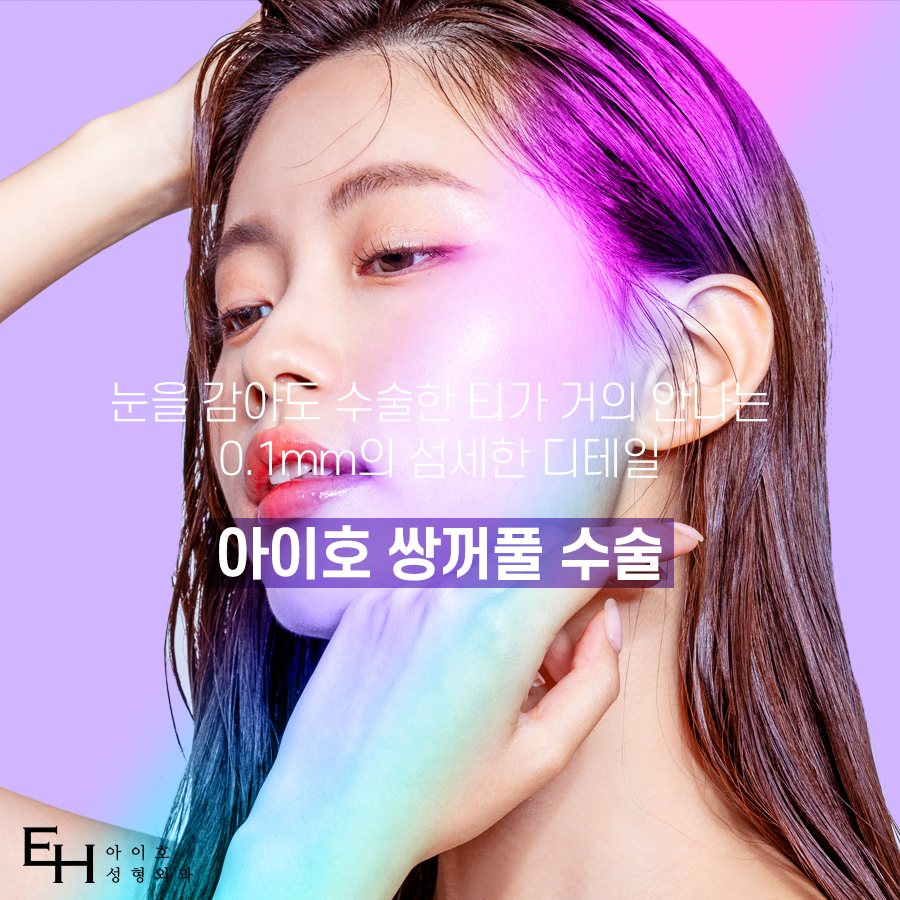 쌍꺼풀수술 가격 & 비절개 눈매교정 후기 (7일 경과) / 짝눈쌍수 관련 이미지 1