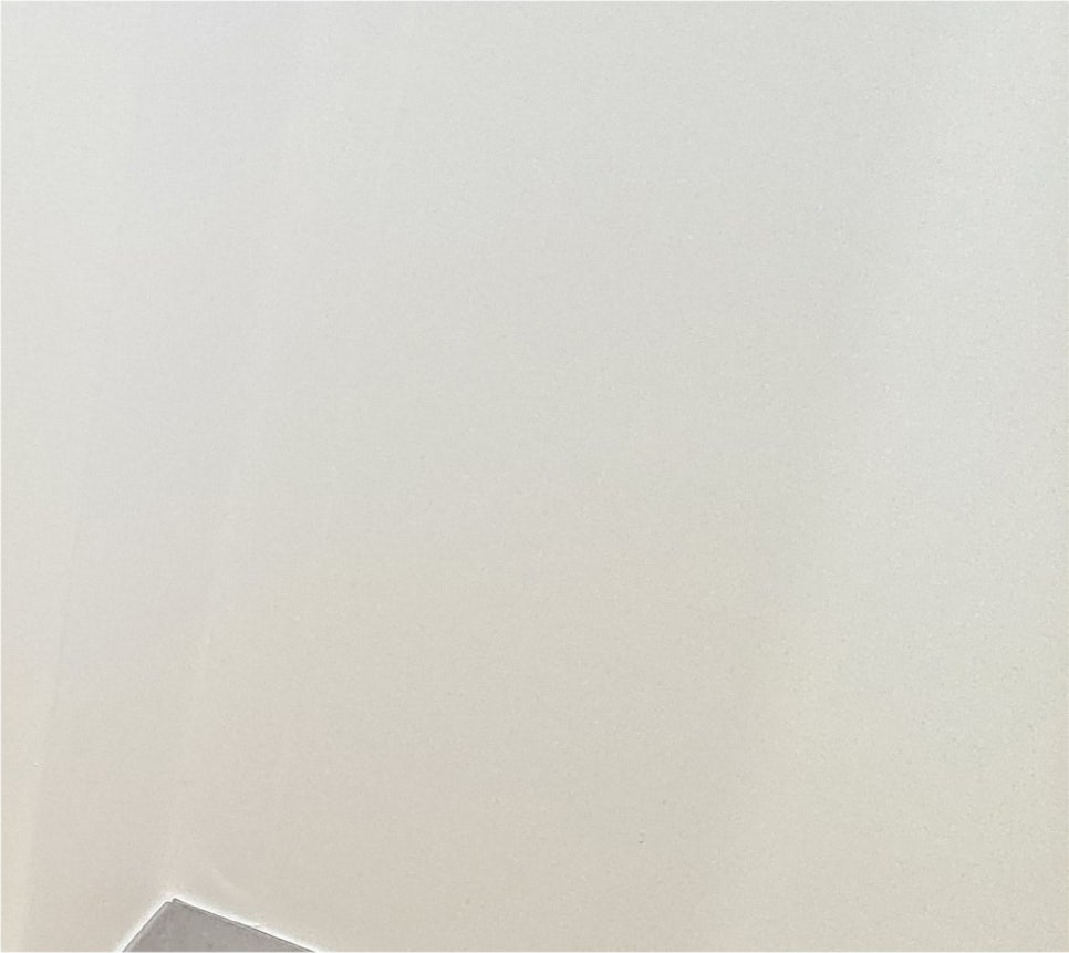 눈재수술 마지막이 되려면 눈전문성형외과에서 관련 이미지 18