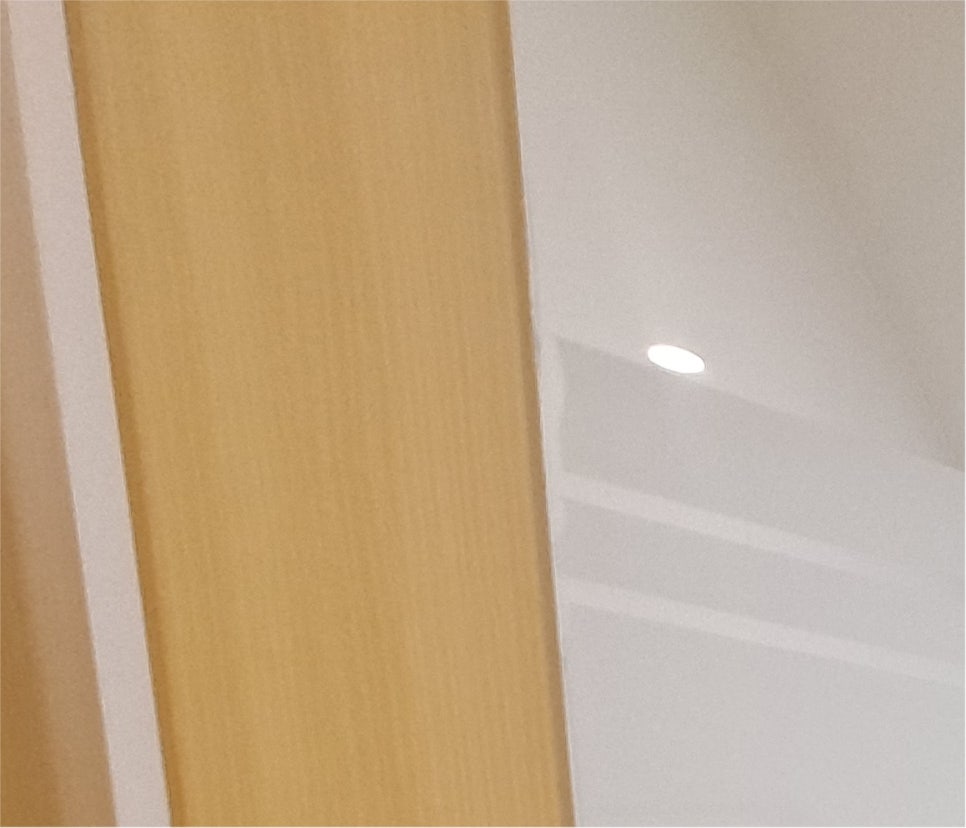 남자눈성형 자연스러운 눈매 후기 관련 이미지 15