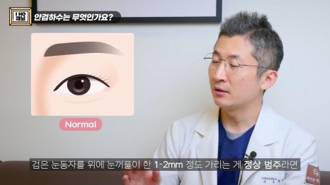 Can Eye Correction Surgery to Improve Ptosis Be Done for Everyone Who Has Trouble Opening Their Eyes? image 5
