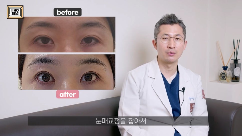 소세지눈 다 같은 게 아니다!? 유형별 재수술 방법에 대해 알려드리겠습니다. 관련 이미지 59