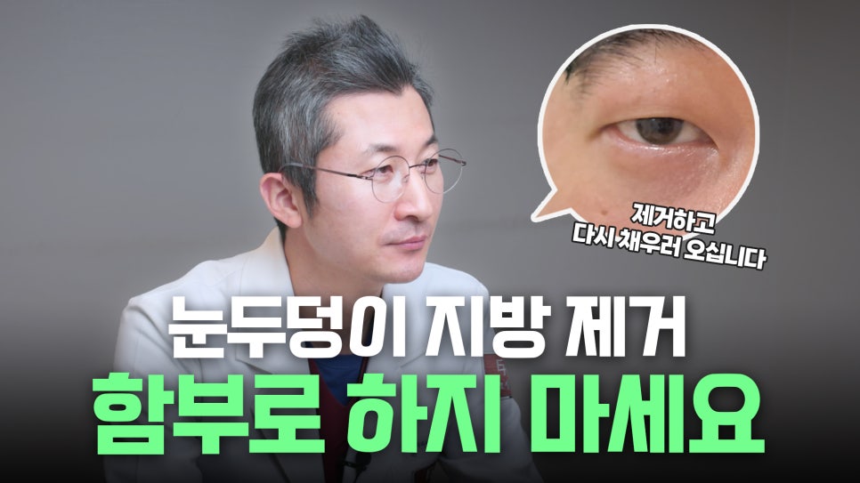 Upper Eyelid Fat Removal: Solving the Problem of Puffy-Looking Eyes!! image 53