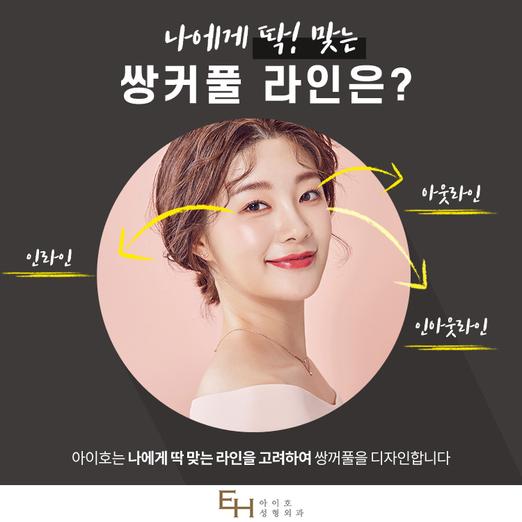 쌍수 후 비대칭 눈, 쌍꺼풀재수술 매몰법 재교정 관련 이미지 3