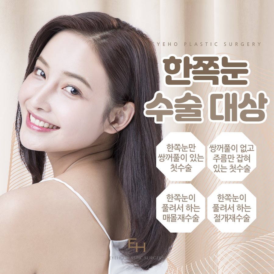 비대칭 짝눈교정 한쪽눈성형으로 대칭을 이루세요. 관련 이미지 3