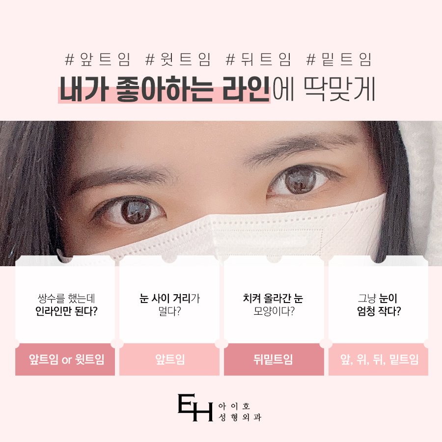 [눈수술 종류] 트임성형 자연스럽게 시원하게 관련 이미지 3