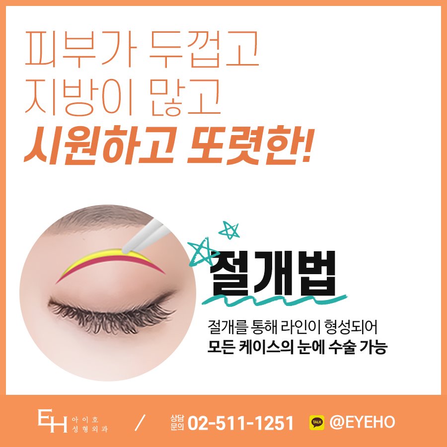 쌍꺼풀수술비용 결과는 중요하니까 비교 분석 관련 이미지 3