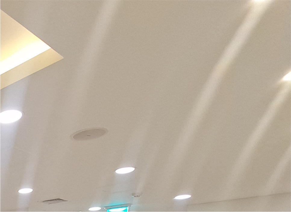 쌍꺼풀수술 가격 & 비절개 눈매교정 후기 (7일 경과) / 짝눈쌍수 관련 이미지 18