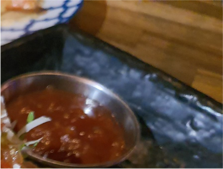 쌍꺼풀재수술비용 꼼꼼하게 살펴야 관련 이미지 23