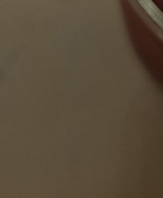 남자눈매교정전후 자연스러운 변화를 원한다면 관련 이미지 25