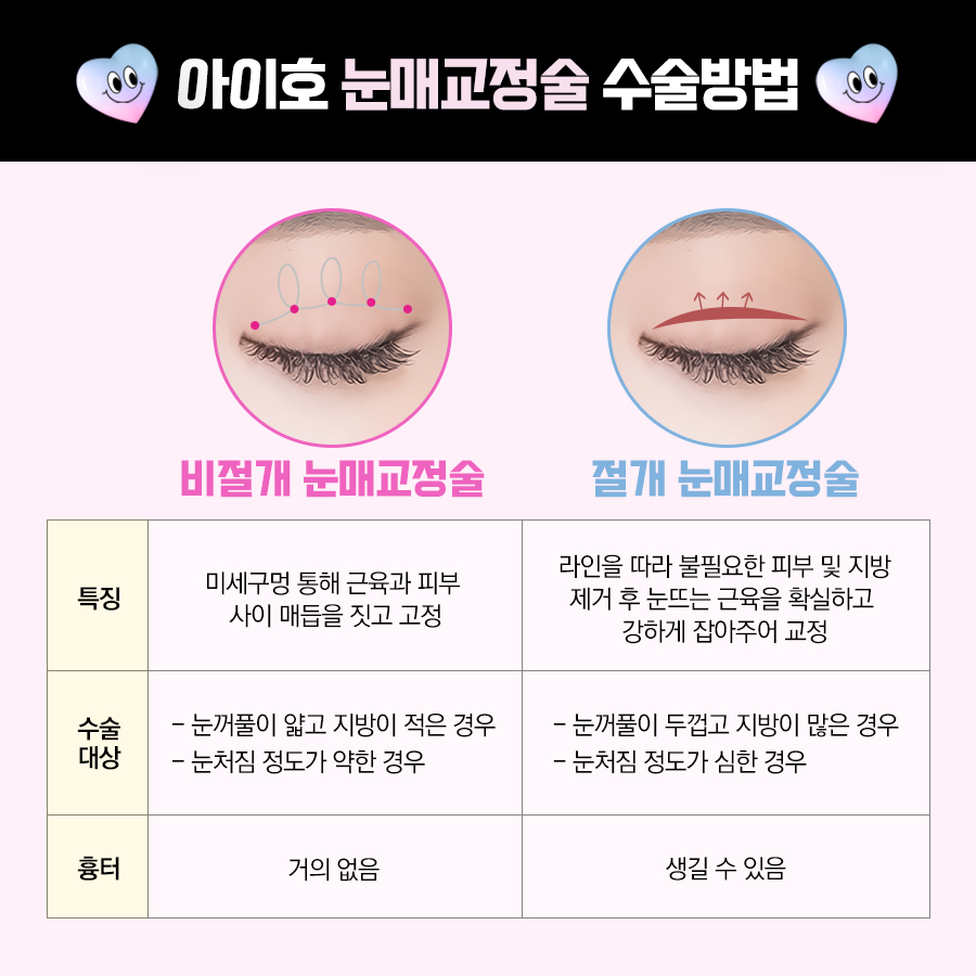 눈매교정술 또렷한 눈매나 관련 이미지 5