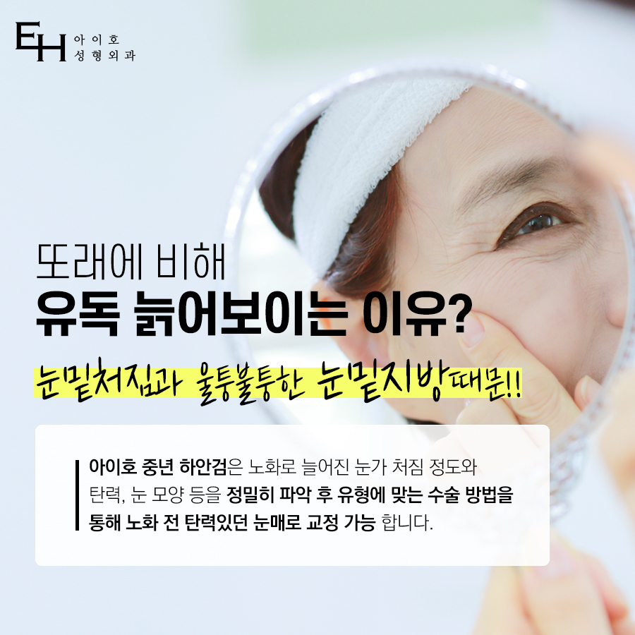하안검수술 : 눈밑처짐수술 / 하안검 수술 후기, 비용, 회복기간, 부작용 관련 이미지 2