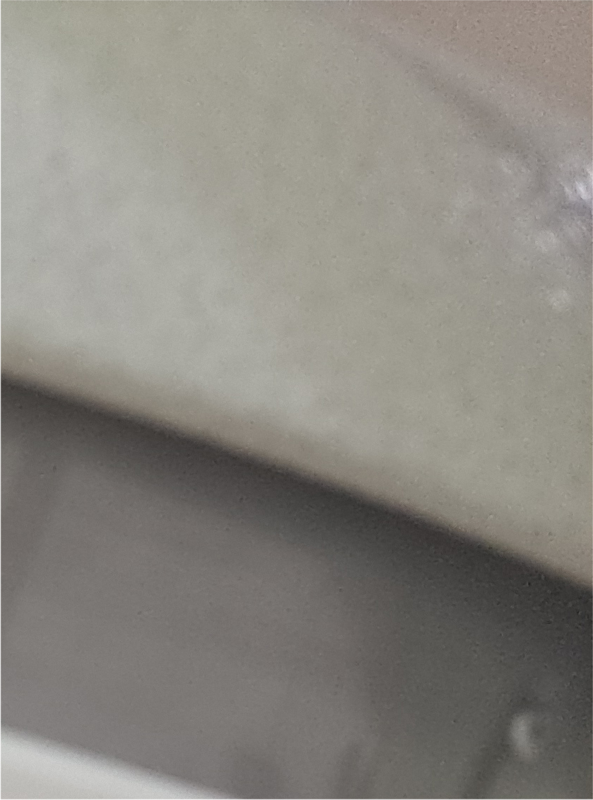 Resolving Concerns About Multiple Eyelids at a Clinic Specializing in Revision Double Eyelid Surgery image 20