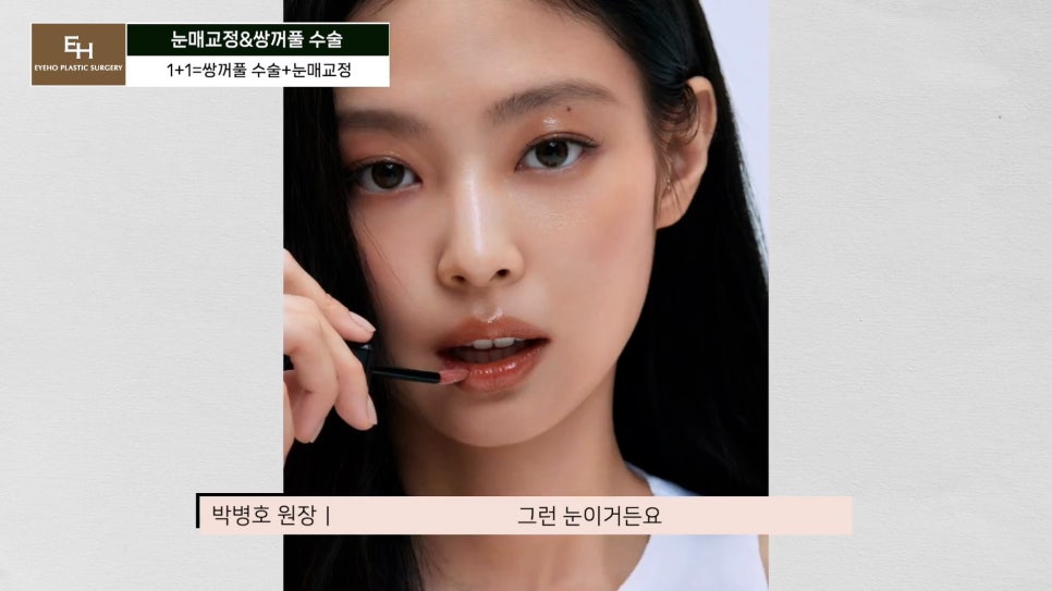 Double Eyelid Surgery and Ptosis Correction Must Be Done Together!? Here Is the Truth. image 44