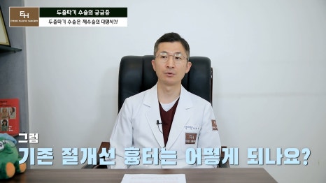 더 이상 물러설 때가 없는 재수술 두줄따기 궁금해요! 관련 이미지 33