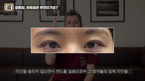 앞트임, 윗트임 하지 말아야할 눈!! 관련 이미지 10