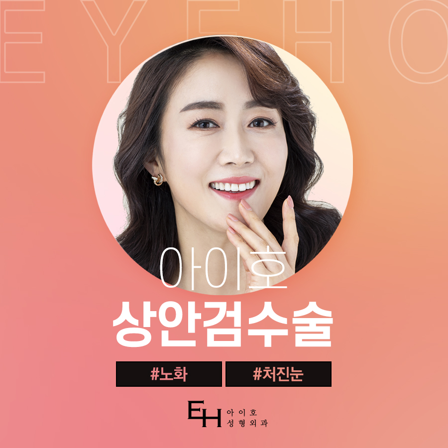 상안검 수술 후기 : 상안검수술비용 그리고 회복기간 관련 이미지 5