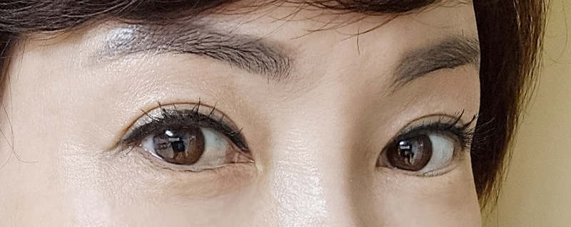 상안검수술가격 답답한 눈매를 시원하게 관련 이미지 1
