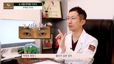 눈재수술 고민이신 분들 주목!! 관련 이미지 6