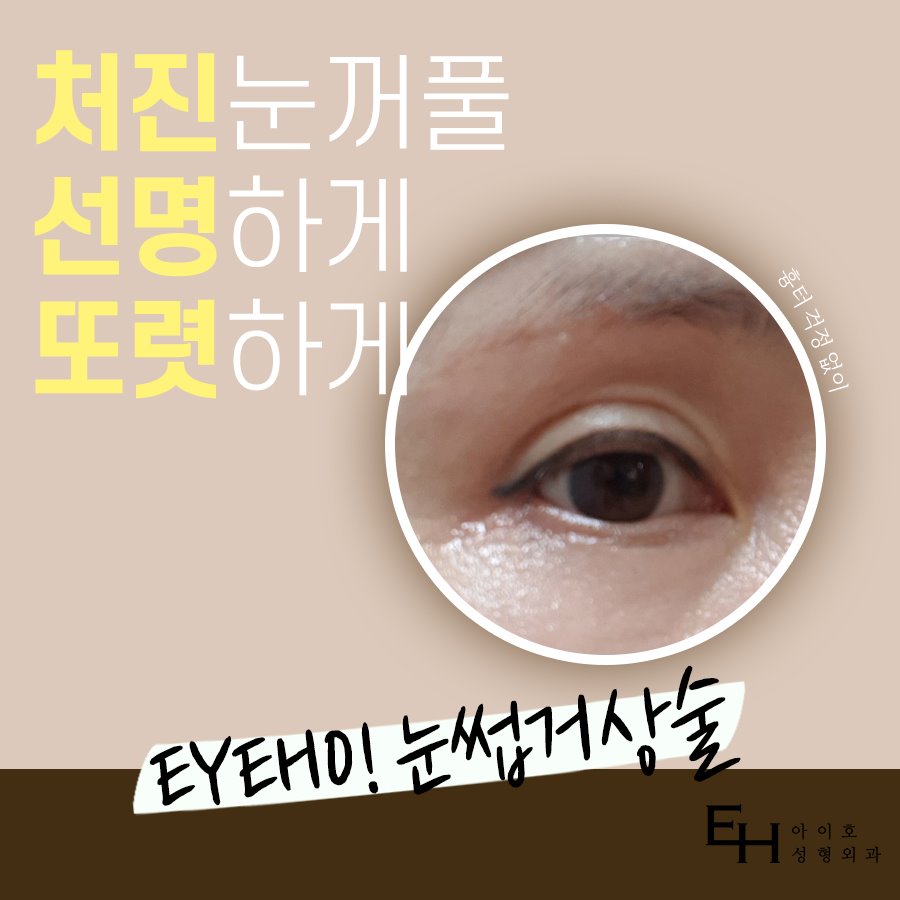 Brow Lift Cost and Brow Lift Review, Pain, and Precautions image 2