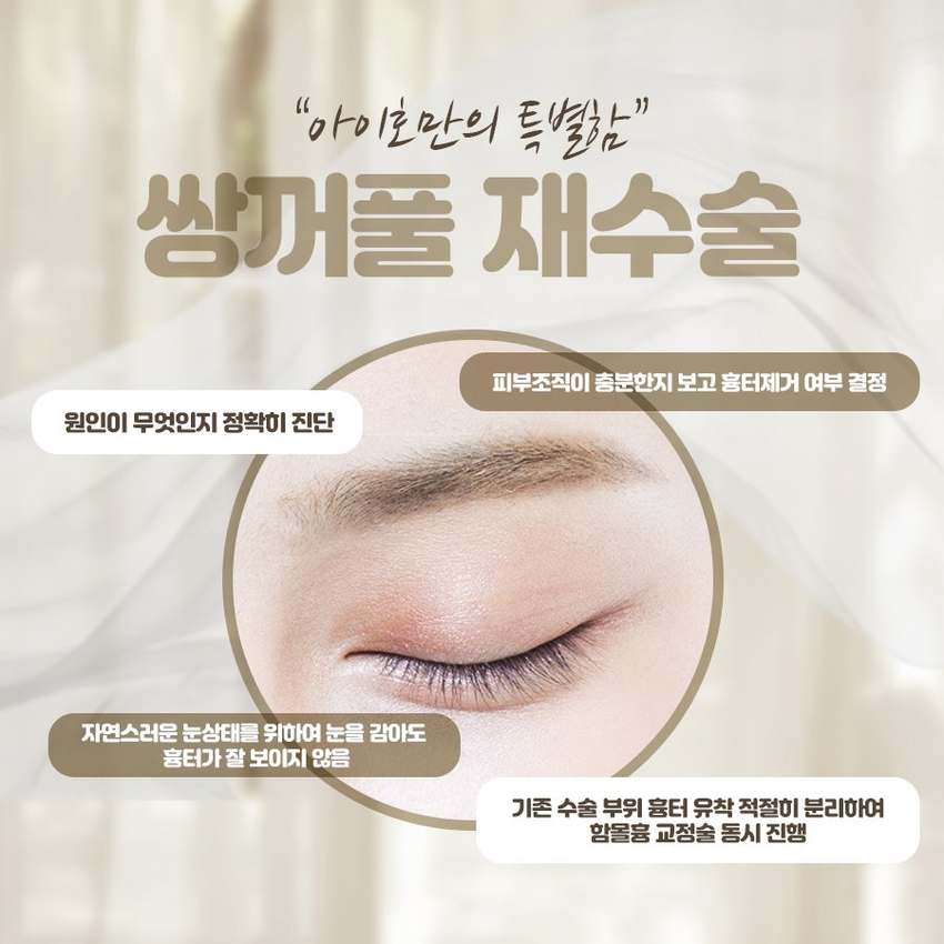 Double Eyelid Revision Surgery Cost: Check Everything Carefully, Including the Results image 2
