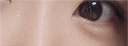 If You’re Considering Non-Incisional Eye Correction Surgery, Compare Reviews image 25