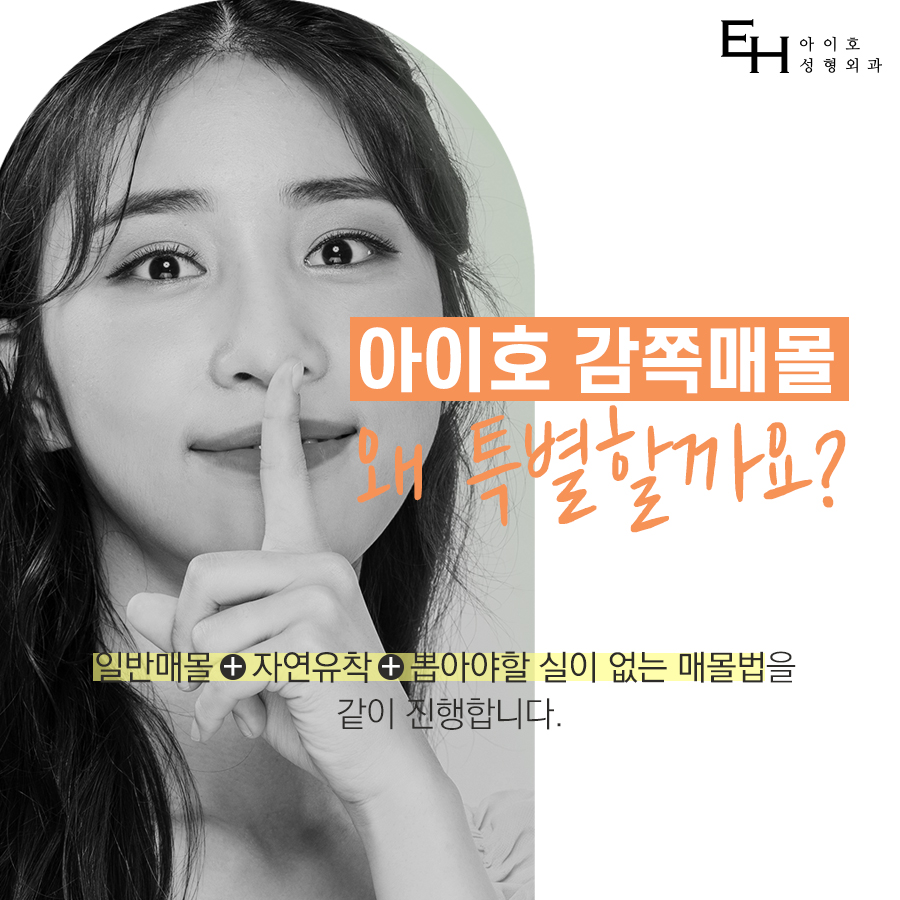 What to Consider for Satisfied Double Eyelid Burial Method Results image 4