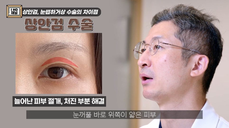 Which Is the Right Surgery for Me for Sagging Eyelids: Upper Blepharoplasty or Brow Lift? image 2
