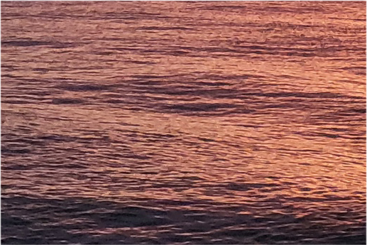 Lower Blepharoplasty: Under-Eye Sagging Surgery, Lower Blepharoplasty Pain, Cost, and Side Effects image 22
