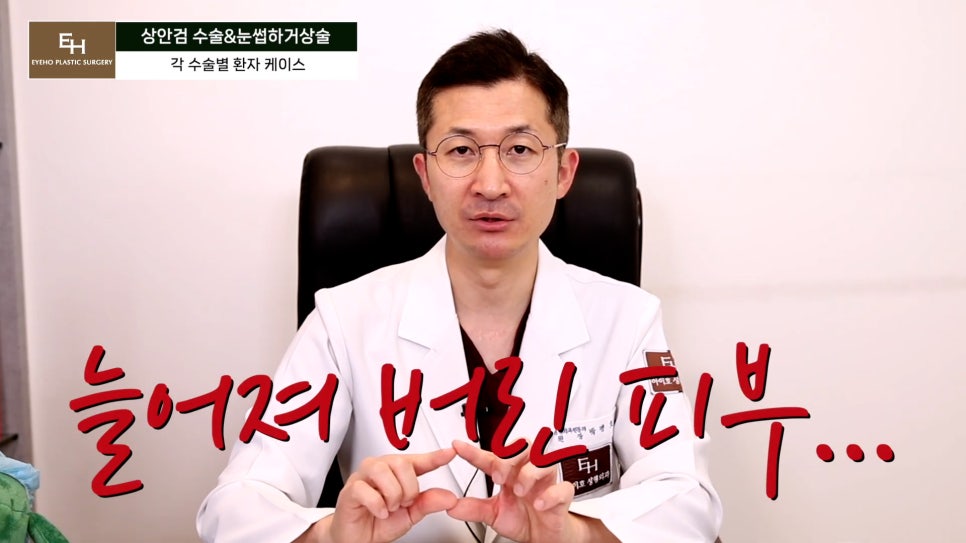 처진눈 상안검? 눈썹하거상술? 궁금하시다면 들어와!! 관련 이미지 31