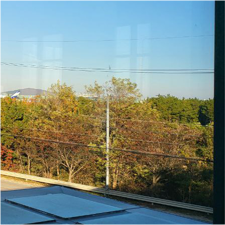 꼬막눈쌍수 시원하게 개선하려면 관련 이미지 21